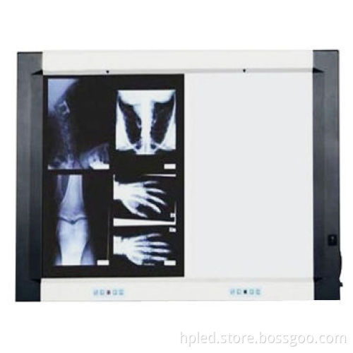 X-film Viewer Box